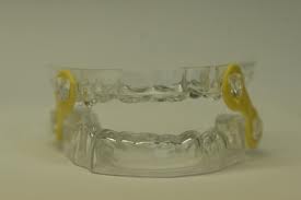 Sleep Apnea Treatment Sleep Apnea Dental Appliance Sleep Apnea Treatment Methods