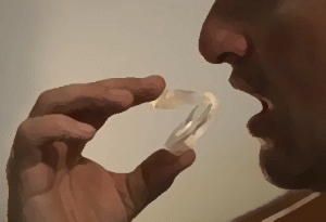 snore-no-more-mouthpiece