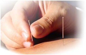 What Are The Natural Remedies For Narcolepsy Acupuncture What Are The Natural Remedies For Narcolepsy Acupuncture