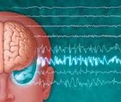 Can Lack Of Sleep Cause Seizures And Lethargic Symptoms Can Lack Of Sleep Cause Seizures And Lethargic Symptoms & Sleep Disorders