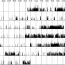 Irregular Sleep Wake Rhythm And Actigraphy