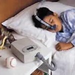 Sleep apnea in children
