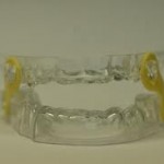 Sleep Apnea Treatment | Sleep Apnea Dental Appliance