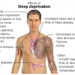 Sleep Deprivation Consequences | What’s the Worst Thing That Can Happen?