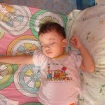 Can A Child With Sleep Apnea May Also Have Epilepsy