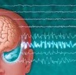 Seizure And Sleep Disorders