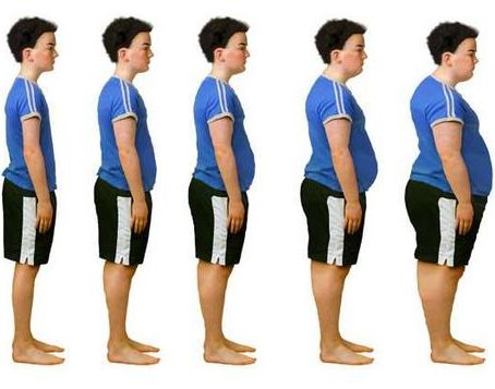Obesity Linked to Sleep Deprivation 
