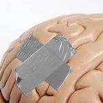 Does A Head Injury Can Cause Disruption Of Circadian Rhythm