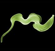 Sleeping Sickness or African Sleeping Sickness Overview
